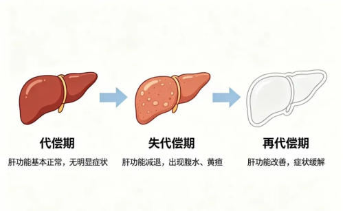 【案例实录】从失代偿到再代偿，我院崔占吉主任见证肝硬化男子实现惊人蜕变