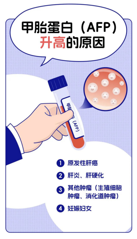 甲胎蛋白升高就是肝癌吗？济南中医肝病医院陈士俊主任：别被指标吓住
