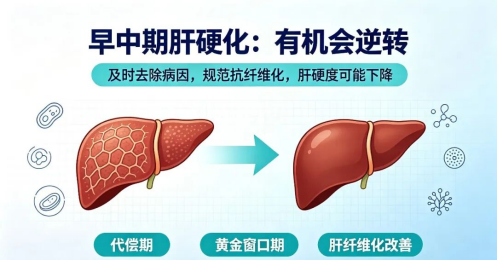 肝硬化并非终局，科学干预有望实现逆转｜济南中医肝病医院洪臣主任带你走出“肝”扰