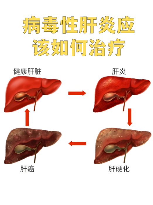 认清4大类常见肝病，济南中医肝病医院带您守住肝脏健康