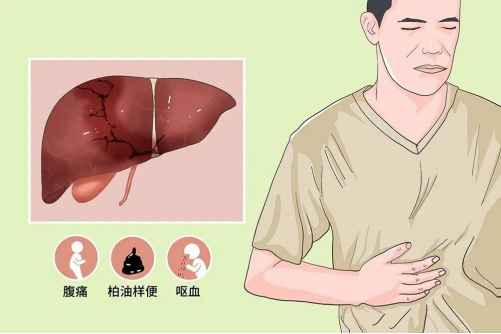 凶险重症肝炎别硬扛！济南中医肝病医院中西医结合施治，锦旗见证实效