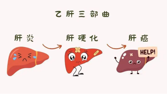 阻断乙肝三部曲，济南中医肝病医院有方法