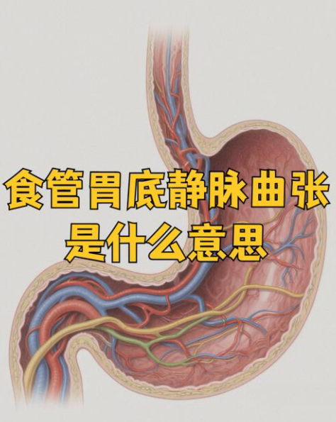 出血猛如虎，护肝有温度｜济南中医肝病医院为您解除肝硬化食管胃底静脉曲张破裂出血风险